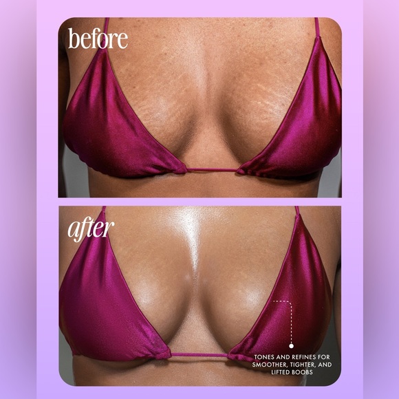 TRULY | Acai Your Boobies Boob Serum - Picture 5 of 6